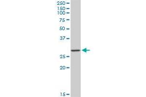 MAGEA12 monoclonal antibody (M01), clone 3A10. (MAGEA12 抗体  (AA 70-168))