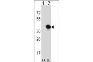 Western Blotting (WB) image for anti-Replication Factor C (Activator 1) 5, 36.5kDa (RFC5) (AA 170-200) antibody (ABIN389314)