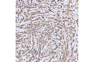 IHC analysis of SSRP1 using anti-SSRP1 antibody (ABIN7600496). (SSRP1 抗体  (AA 2-381))