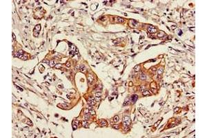 Immunohistochemistry (IHC) image for anti-Signal Transducer and Activator of Transcription 6, Interleukin-4 Induced (STAT6) (AA 1-319) antibody (ABIN7169690)