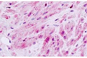 Human, Prostate, smooth muscle: Formalin-Fixed Paraffin-Embedded (FFPE) (MAP3K9 抗体  (Internal Region))