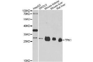 Western blot analysis of extracts of various cell lines, using TPK1 antibody. (TPK1 抗体  (AA 1-243))