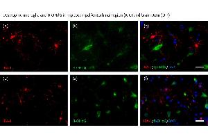 Aged human brain tissue samples of individuals with morphologically dystrophic (a–f) and microglia were stained with an anti-IBA-1 antibody (red: a, d), anti-8-OHdG antibody (green: b, e), and DAPI (blue). (8-OHDG 抗体)