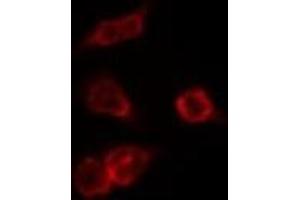 Immunofluorescence (fixed cells) (IF/ICC) image for anti-CD40 Ligand (CD40LG) (Internal Region) antibody (ABIN6260624)