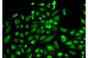 Immunofluorescence analysis of HeLa cell using SPHK1 antibody. (SPHK1 抗体  (AA 50-384))