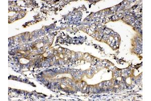IHC analysis of Calpain 2 using anti-Calpain 2 antibody . (Calpain 2 抗体  (AA 500-700))