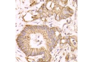 Immunohistochemistry (IHC) image for anti-Catenin (Cadherin-Associated Protein), delta 1 (CTNND1) (AA 573-832) antibody (ABIN3022309)