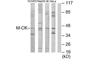 Western Blotting (WB) image for anti-Creatine Kinase, Muscle (CKM) (N-Term) antibody (ABIN1849112) (CKM 抗体  (N-Term))
