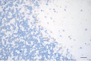 Immunohistochemistry was performed on paraffin-embedded mouse brain using METTL3 antibody (ABIN7799400), 1:200). (Recombinant METTL3 抗体)