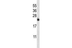 IL-13 antibody western blot analysis in NCI-H460 lysate (IL-13 抗体  (AA 118-146))