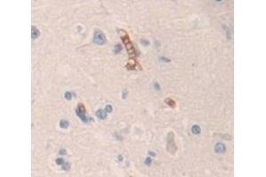 Used in DAB staining on fromalin fixed paraffin- embedded Kidney tissue (Contactin 6 抗体  (AA 658-907))