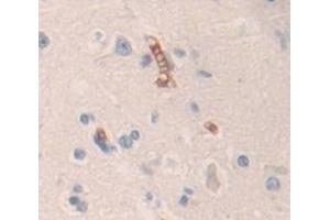 Used in DAB staining on fromalin fixed paraffin- embedded Kidney tissue (Contactin 6 抗体  (AA 658-907))