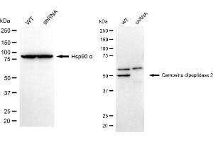 Western blotting analysis using carnosine dipeptidase 2 antibody (ABIN7798103). (CNDP2 抗体)