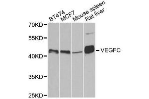 Western blot analysis of extracts of various cell lines, using VEGFC antibody. (VEGFC 抗体)