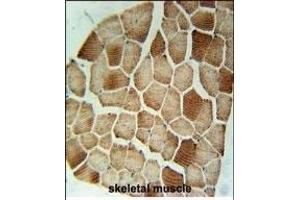 STX7 Antibody (N-term) (ABIN1881855 and ABIN2840425) immunohistochemistry analysis in formalin fixed and paraffin embedded human skeletal muscle followed by peroxidase conjugation of the secondary antibody and DAB staining. (Syntaxin 7 抗体  (N-Term))