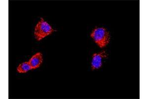 Proximity Ligation Assay (PLA) image for AKT1 & FOXO3 Protein Protein Interaction Antibody Pair (ABIN1340060)