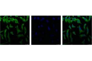 Immunofluorescence staining of HeLa cell line with antibody (Left), DAPI (Middle) and merge (Right). (EIF4A1 抗体  (C-Term))