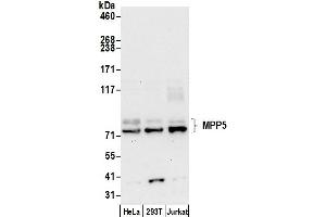 Western Blotting (WB) image for anti-Membrane Protein, Palmitoylated 5 (MAGUK P55 Subfamily Member 5) (MPP5) (AA 600-650) antibody (ABIN7450460)
