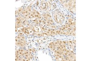 Immunohistochemistry of paraffin-embedded rat ovary using TAZ Rabbit pAb (ABIN6130800, ABIN6150278, ABIN6150279 and ABIN6224227) at dilution of 1:50 (40x lens). (WWTR1 抗体  (AA 1-230))
