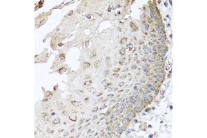 Immunohistochemistry of paraffin-embedded human esophagus using IRS2 antibody (ABIN5974770) at dilution of 1/100 (40x lens). (IRS2 抗体)