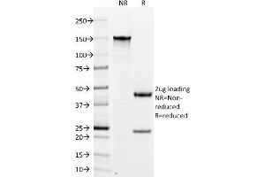 SDS-PAGE Analysis Purified PLGF Monoclonal Antibody (PLGF/94). (PLGF 抗体)