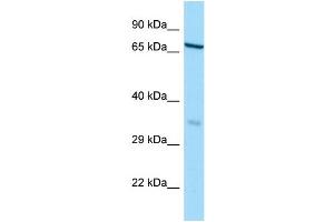 WB Suggested Anti-HAUS3 Antibody Titration: 1. (HAUS3 抗体  (N-Term))