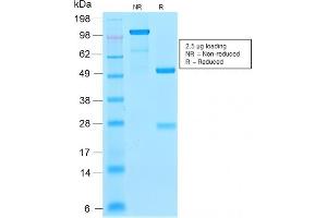 SDS-PAGE Analysis Purified p21 Rabbit Recombinant Monoclonal Antibody (CIP1/2275R). (Recombinant p21 抗体)