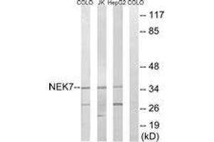 Western blot analysis of extracts from HepG2/Jurkat/COLO cells, using NEK7 Antibody. (NEK7 抗体  (AA 101-150))