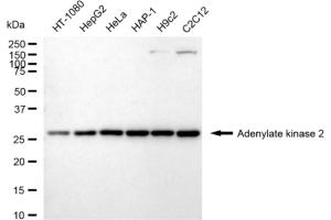 anti-Adenylate Kinase 2 (AK2) antibody