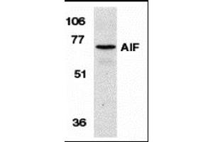 Western blot analysis of AIF in K562 cell lysate with AIF antibody at 1 µg/mL. (AIF 抗体  (N-Term))