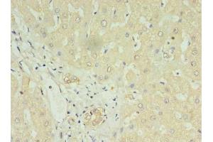 Immunohistochemistry of paraffin-embedded human liver tissue using ABIN7158666 at dilution of 1:100 (LYRM1 抗体  (AA 1-122))