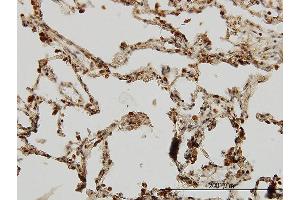 Immunoperoxidase of monoclonal antibody to IRAK1 on formalin-fixed paraffin-embedded human lung. (IRAK1 抗体  (AA 530-693))