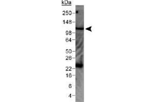 Western blot analysis of WNK4 in mouse kidney lysate with WNK4 polyclonal antibody . (WNK4 抗体  (AA 200-300))