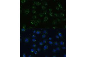 Immunofluorescence analysis of C6 cells using COPG2 Polyclonal Antibody (ABIN7266425) at dilution of 1:100 (40x lens). (COPG2 抗体  (AA 542-871))