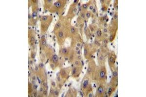 Immunohistochemistry analysis in formalin fixed and paraffin embedded human liver tissue reacted with PAGE5 Antibody (C-term) followed which was peroxidase conjugated to the secondary antibody and followed by DAB staining. (PAGE5 抗体  (C-Term))