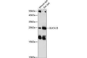 Western blot analysis of extracts of various cell lines, using GUCB antibody (4739) at 1:1000 dilution. (GUCA1B 抗体  (AA 1-200))