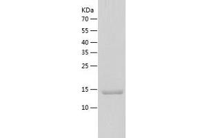 Western Blotting (WB) image for Leukocyte-Associated Immunoglobulin-Like Receptor 1 (LAIR1) (AA 22-165) protein (His tag) (ABIN7123760)