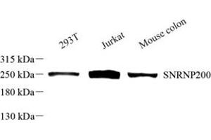 Western blot analysis of SNRNP200 (ABIN7075632) at dilution of 1: 500 (SNRNP200 抗体)