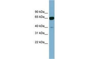 Image no. 1 for anti-Zinc Finger Protein 169 (ZNF169) (AA 71-120) antibody (ABIN6742078) (ZNF169 抗体  (AA 71-120))