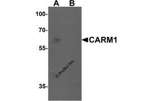 Western Blotting (WB) image for anti-Coactivator-Associated Arginine Methyltransferase 1 (CARM1) (N-Term) antibody (ABIN1077435) (CARM1 抗体  (N-Term))