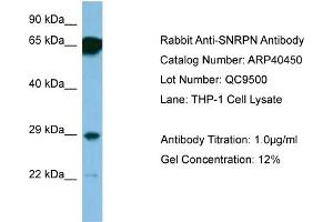 WB Suggested Anti-SNRPN Antibody   Titration: 1. (SNRPN 抗体  (N-Term))