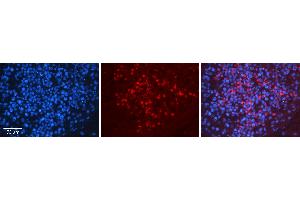 Rabbit Anti-HNRNPU Antibody   Formalin Fixed Paraffin Embedded Tissue: Human Testis Tissue Observed Staining: Cytoplasm and nucleus in spermatogonia and spermatocytes Primary Antibody Concentration: N/A Other Working Concentrations: 1:600 Secondary Antibody: Donkey anti-Rabbit-Cy3 Secondary Antibody Concentration: 1:200 Magnification: 20X Exposure Time: 0. (HNRNPU 抗体  (N-Term))