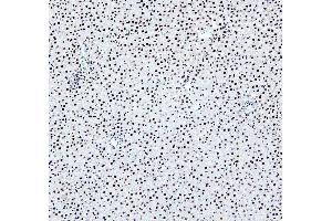 IHC analysis of PTBP2 using anti-PTBP2 antibody (ABIN7599452). (PTBP2 抗体  (AA 1-504))