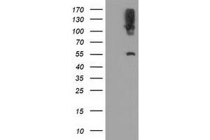 Western Blotting (WB) image for anti-Lipase, Endothelial (LIPG) antibody (ABIN1499173) (LIPG 抗体)