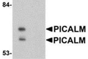 Western blot analysis of PICALM in EL4 cell lysate with this product at 1 μg/ml in (A) the absence and (B) the presence of blocking peptide.