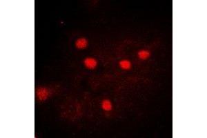Immunofluorescent analysis of USP26 staining in A549 cells. (USP26 抗体)