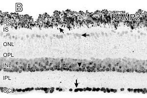 Immunocytochemical localization of the adrenomedullin (ADM) receptor calcitonin receptor like receptor (CRLR) and receptor activity modifying protein (RAMP2). (RAMP2 抗体  (C-Term))