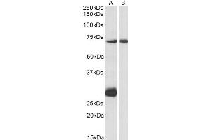 ABIN571078 (1µg/ml) staining of Mouse Heart (A) and Liver (B) lysate (35µg protein in RIPA buffer). (CPT2 抗体  (AA 141-154))