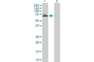 Western Blot analysis of IFNGR1 expression in transfected 293T cell line by IFNGR1 MaxPab polyclonal antibody. (IFNGR1 抗体  (AA 1-489))