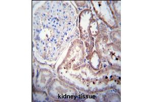 SCDGFB Antibody (Center) (ABIN390196 and ABIN2840684) immunohistochemistry analysis in formalin fixed and paraffin embedded human kidney tissue followed by peroxidase conjugation of the secondary antibody and DAB staining. (PDGFD 抗体  (AA 313-341))